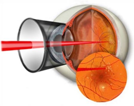 Клиники лазерной хирургии глаза в пятигорске