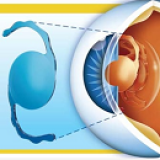 Клиника глазных болезней пенза