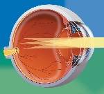 Какие лучше детская глазная клиника в москве по астигматизму