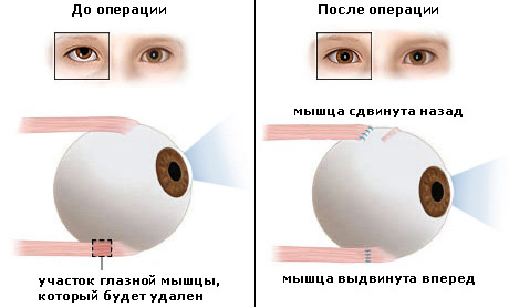 Глазная клиника в александрове цены на операции