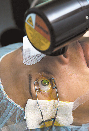 Лечение катаракты в виннице